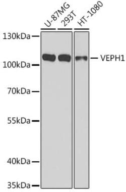 VEPH1 Antibody - BSA Free, Novus Biologicals 0.1 mL; Unconjugated:Antibodies,