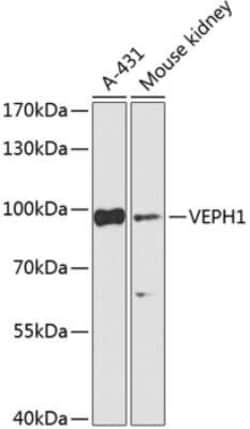 VEPH1 Antibody - BSA Free, Novus Biologicals 0.02 mL; Unconjugated:Antibodies,