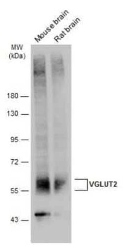 VGLUT2 Antibody, Novus Biologicals 100 &mu;g | Buy Online | Novus Biologicals | Fisher Scientific