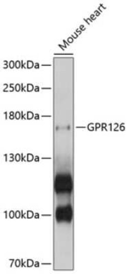 VIGR/GPR126 Antibody - BSA Free, Novus Biologicals 0.02 mL, Unconjugated:Antibodies,