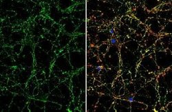 VIP Antibody, Novus Biologicals 100 &mu;g; Unconjugated:Antibodies, Polyclonal