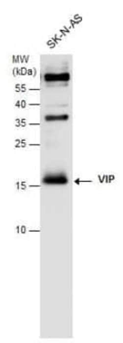 VIP Antibody, Novus Biologicals 100 &mu;g; Unconjugated:Antibodies, Polyclonal