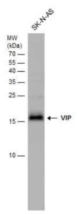 VIP Antibody, Novus Biologicals 100 &mu;g | Buy Online | Novus Biologicals | Fisher Scientific