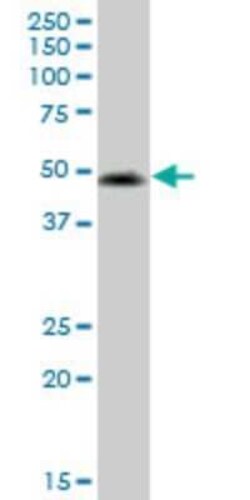 VIPR2/VPAC2 Antibody (2E3), Novus Biologicals 0.1 mg | Buy Online | Novus Biologicals | Fisher Scientific
