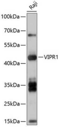 VIPR1/VPAC1 Antibody - BSA Free, Novus Biologicals 0.1 mL | Buy Online | Novus Biologicals | Fisher Scientific