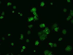 VKORC1 Antibody, Novus Biologicals 100 &mu;g, Unconjugated:Antibodies,