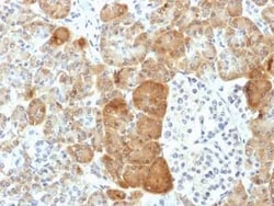 VLDLR Antibody (VLDLR/1337), Novus Biologicals 100&mu;g; Unlabeled:Antibodies,