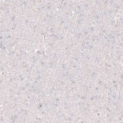 VMAT2 Antibody (CL12531), Novus Biologicals:Antibodies:Primary Antibodies