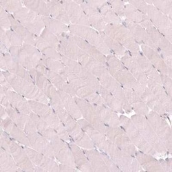VMAT2 Antibody (CL13157), Novus Biologicals 100 &mu;g; Unconjugated:Antibodies,