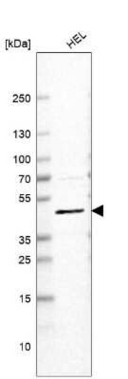 VMAT2 Antibody (CL13157), Novus Biologicals 100 &mu;g; Unconjugated:Antibodies,