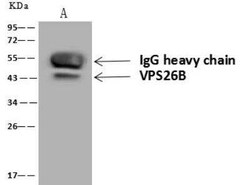 VP26B Antibody, Novus Biologicals 50 &mu;g; Unconjugated:Antibodies, Polyclonal