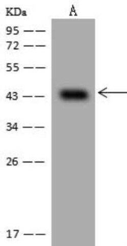VP26B Antibody, Novus Biologicals 50 &mu;g; Unconjugated:Antibodies, Polyclonal