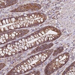 VPS16 Antibody, Novus Biologicals:Antibodies:Primary Antibodies