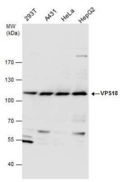 VPS18 Antibody, Novus Biologicals 100 &mu;g | Buy Online | Novus Biologicals | Fisher Scientific