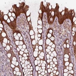 VPS24 Antibody, Novus Biologicals:Antibodies:Primary Antibodies