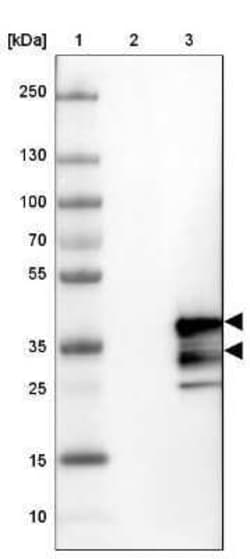 VPS24 Antibody, Novus Biologicals:Antibodies:Primary Antibodies