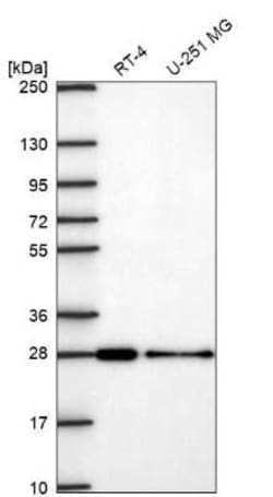 VPS24 Antibody, Novus Biologicals:Antibodies:Primary Antibodies