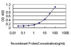 VPS25 Antibody (2E5-2B9), Novus Biologicals 0.1 mg | Buy Online | Novus Biologicals | Fisher Scientific