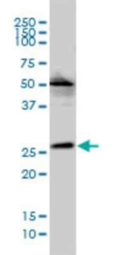 VPS25 Antibody (2E5-2B9), Novus Biologicals 0.1 mg | Buy Online | Novus Biologicals | Fisher Scientific
