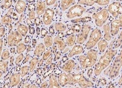 VPS25 Antibody, Novus Biologicals 50 &mu;g; Unconjugated:Anticuerpos