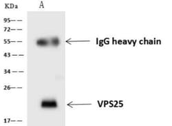 VPS25 Antibody, Novus Biologicals 50 &mu;g; Unconjugated:Anticuerpos
