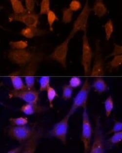 VPS26A Antibody - Azide and BSA Free, Novus Biologicals 0.02 mL; Unconjugated:Antibodies,