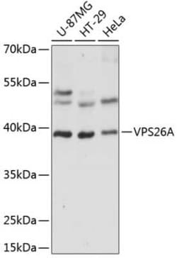 VPS26A Antibody - Azide and BSA Free, Novus Biologicals 0.02 mL; Unconjugated:Antibodies,