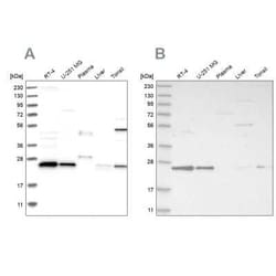VPS28 Antibody, Novus Biologicals 25 &mu;L | Buy Online | Novus Biologicals | Fisher Scientific
