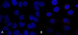VPS35 Antibody (7E4), Novus Biologicals 100 &mu;g; Unconjugated:Antibodies,