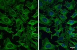 VPS35 Antibody (HL1017), Novus Biologicals 100 &mu;g | Buy Online | Novus Biologicals | Fisher Scientific