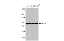 VPS35 Antibody (HL1017), Novus Biologicals 100 &mu;g | Buy Online | Novus Biologicals | Fisher Scientific