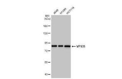 VPS35 Antibody (HL1017), Novus Biologicals 100 &mu;g | Buy Online | Novus Biologicals | Fisher Scientific