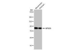 VPS35 Antibody (HL1017), Novus Biologicals 100 &mu;g | Buy Online | Novus Biologicals | Fisher Scientific