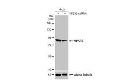 VPS35 Antibody (HL1017), Novus Biologicals 100 &mu;g | Buy Online | Novus Biologicals | Fisher Scientific