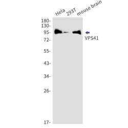 VPS41 Rabbit anti-Human, Mouse, Rat, Clone: S08-1J7, Novus Biologicals