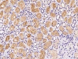 VPS52 Antibody, Novus Biologicals 100 &mu;g, Unconjugated:Antibodies, Polyclonal