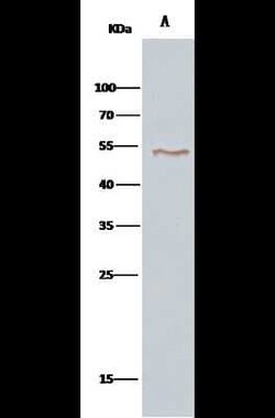 VRK1 Antibody, Novus Biologicals:Antibodies:Primary Antibodies