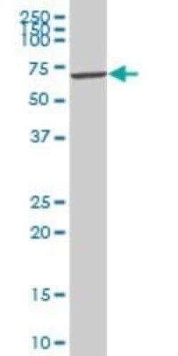 VRK2 Antibody, Novus Biologicals 0.05 mg | Buy Online | Novus Biologicals | Fisher Scientific