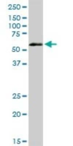 VRK2 Antibody, Novus Biologicals 0.1 mg | Buy Online | Novus Biologicals | Fisher Scientific