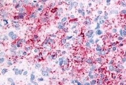 VRL1 Antibody - BSA Free, Novus Biologicals 0.05 mg | Buy Online | Novus Biologicals | Fisher Scientific