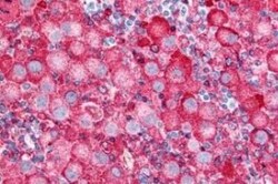 VRL1 Antibody - BSA Free, Novus Biologicals 0.05 mg | Buy Online | Novus Biologicals | Fisher Scientific