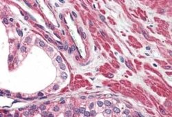 VRL1 Antibody, Novus Biologicals 50 &mu;g | Buy Online | Novus Biologicals | Fisher Scientific