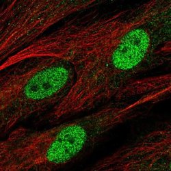 SNHG28 Antibody, Novus Biologicals:Antibodies:Primary Antibodies