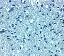 VTI1A Antibody - BSA Free, Novus Biologicals 0.1 mg; Unconjugated:Antibodies,