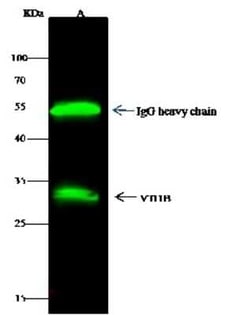VTI1B Antibody, Novus Biologicals 50 &mu;g, Unconjugated:Antibodies, Polyclonal