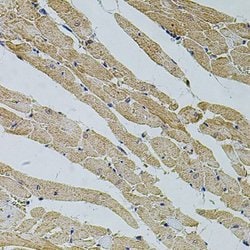 Histone H2AY/macroH2A.1 Rabbit anti-Human, Mouse, Rat, Polyclonal, Novus