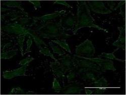Vanin-1/VNN1 Antibody (4E11), Novus Biologicals 0.1 mg | Buy Online | Novus Biologicals | Fisher Scientific
