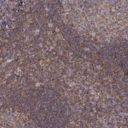 Vav-1 Antibody, Novus Biologicals 0.1 mL | Buy Online | Novus Biologicals | Fisher Scientific