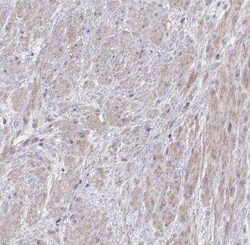 Vav-1 Antibody, Novus Biologicals 0.1 mL | Buy Online | Novus Biologicals | Fisher Scientific