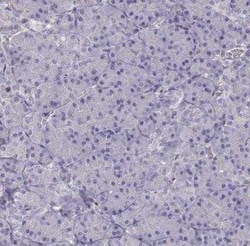 Vav-1 Antibody, Novus Biologicals 0.1 mL | Buy Online | Novus Biologicals | Fisher Scientific
